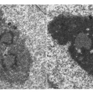 Photographie en microscopie électronique de « nucléoles » qui sont le lieu de fabrication des ribosomes et où le 5-FU s’incorpore dans les ribosomes.