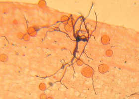 Ovocystes de Plasmodium falciparum dans un intestin d'Anopheles gambiae, vus au microscope,grossissement X20