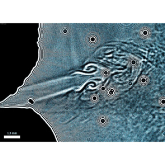 Imagerie laser d'un flux de postillons