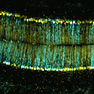 Cette image du cervelet d'une souris exprimant une protéine fluorescente dans les cellules de Purkinje montrant les récepteurs à la dopamine D2.