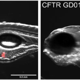 Embryons de poisson-zèbre présentant un défaut d’expression du gène CFTR infecté par la bactérie M. abscessus GD01 (en rouge). A gauche embryon non traité. A droite embryon traité avec le phage Muddy.