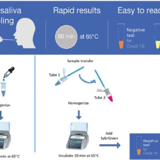 Descriptif fonctionnement test salivaire EasyCov