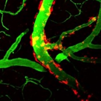 Analyses des plaques amyloïdes dans le cortex superficiel des souris transgéniques J20