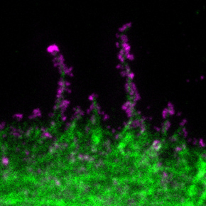 Coronavirus pandémique SARS-CoV2 à la surface des cellules infectées visualisé par microscopie