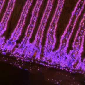 epithelieum