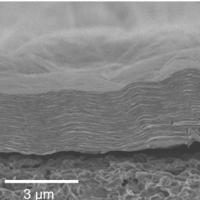 membrane vue par microscopie