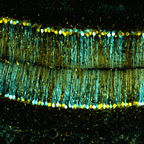 Cette image du cervelet d'une souris exprimant une protéine fluorescente dans les cellules de Purkinje montrant les récepteurs à la dopamine D2.