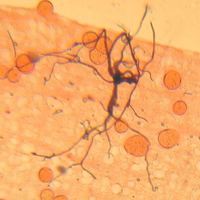 Oocystes de Plasmodium falciparum dans un intestin d'Anopheles gambiae, vus au microscope,grossissement X20