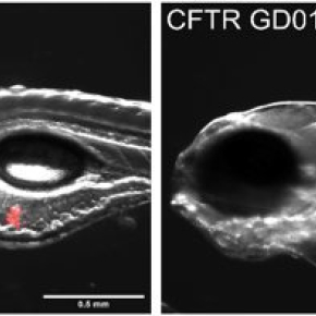 Embryons de poisson-zèbre présentant un défaut d’expression du gène CFTR infecté par la bactérie M. abscessus GD01 (en rouge). A gauche embryon non traité. A droite embryon traité avec le phage Muddy.